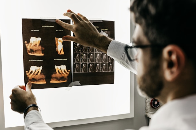 Zahnarzt analysiert Röntgenbild zur Entscheidung zwischen Implantat und Brücke